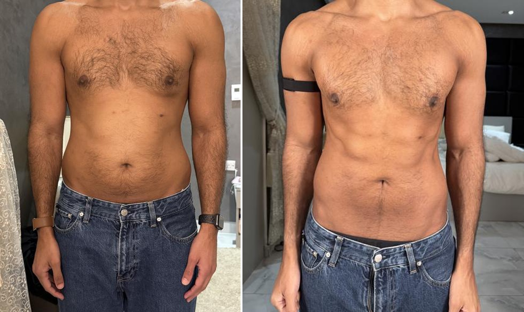Before and after physique transformation of a client